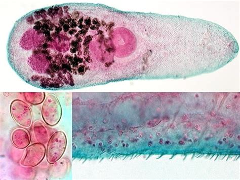  Heterophyes Heterophyes: A Tiny Trematode That's Packed With Surprises!