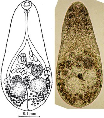  Metagonimus yokogawai:  Unraveling the Mysteries of this Tiny but Troublesome Trematode!